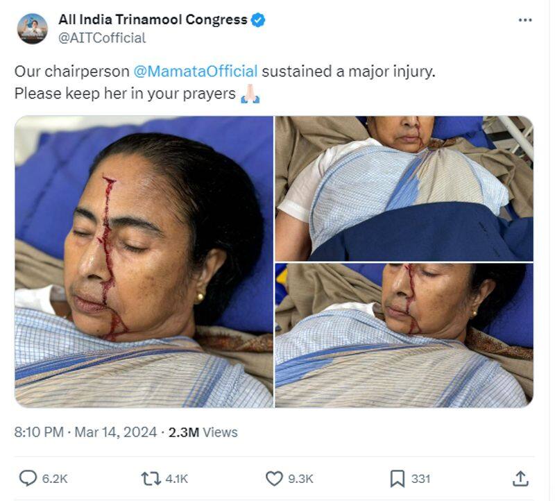 Fact Check Fake photo of Mamata Banerjee injury circulating in social media