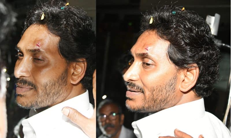Andhra pradesh CM Jagan Mohan Reddy injured after stone pelting in Election campaign Vijaywada ckm