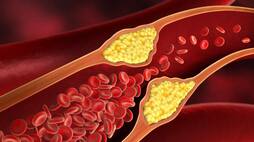 foods to lower bad cholesterol levels naturally at home