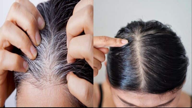 how to use turmeric for white hair home remedies safed baal ke gharelu upay kxa 