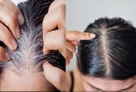 This simple ingredient from your kitchen can help you reverse premature hair greying iwh