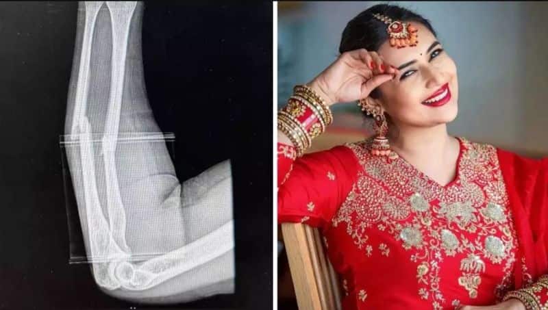 Divyanka Tripathi fractures arm in accident, to undergo surgery jsp