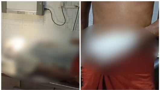 Kerala: Woman attacked for backing out of marriage in Alappuzha; accused arrested anr