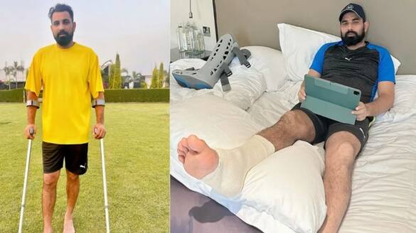 Mohammed Shami has shared a video of himself recovering from injury on his Instagram page rsk
