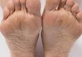5 Ways to remove dead skin from feet zkamn