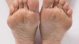 5 Ways to remove dead skin from feet zkamn
