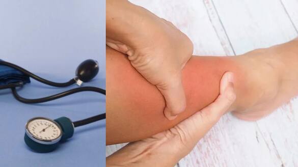 warning signs of high blood pressure in legs and feet 