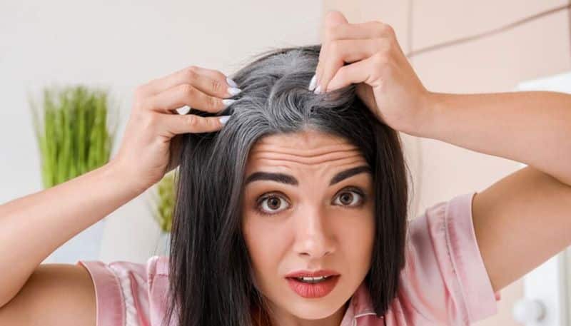 remedies to control hair loss greying of hair