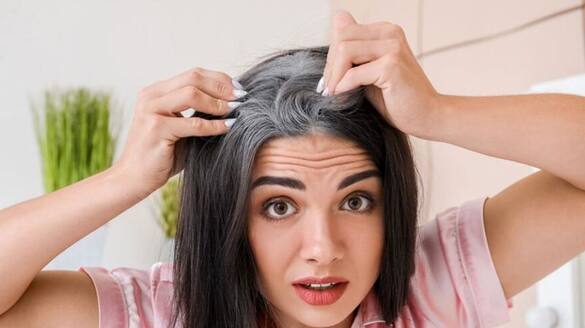remedies to control hair loss greying of hair