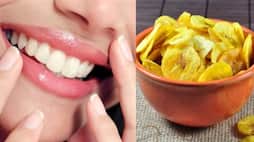 foods and drinks that can damage teeth