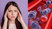 signs and symptoms of anemia you might not notice