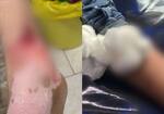 9 people were bitten by a dog in Muvatupuzha; The municipality said that the attack was a pet dog and not stray dog