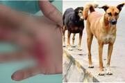 Two elderly people injured in stray dog attack in Nadapuram 25 people bitten in the area in three months