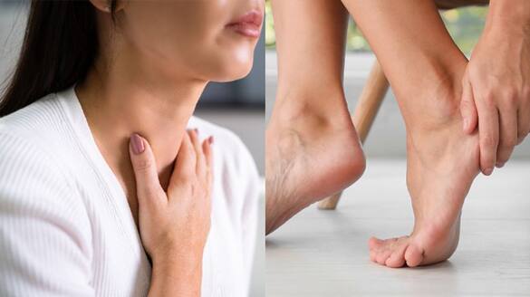 warning signs of thyroid that appear on legs feet