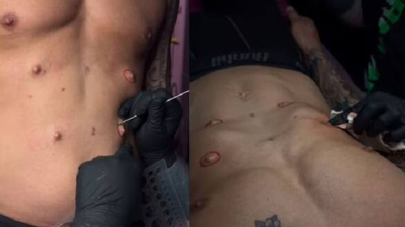 Man Surgically Adds Four Extra Nipples To His Body, Find Out Why Vin