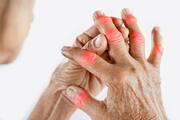 Anti Inflammatory Foods For People With Arthritis