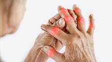 Anti Inflammatory Foods For People With Arthritis