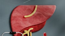 7 symptoms of liver damage