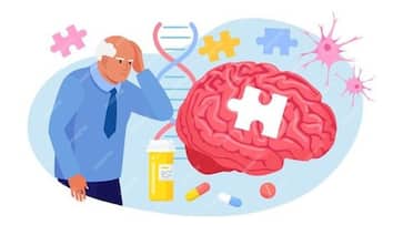 Reason and treatment of memory loss Alzheimer's and dementia zkamn