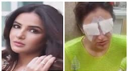 Jasmin Bhasin had problems in eyes nbn