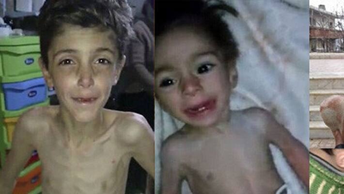 hundreds of children starves to death daily in syria hundreds of children starves to death daily in syria