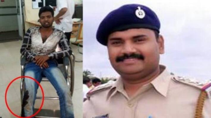 police shot down rowdy in leg police shot down rowdy in leg