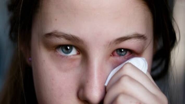 Use this simple home remedy to get a glimpse of the summer Use this simple home remedy to get a glimpse of the summer