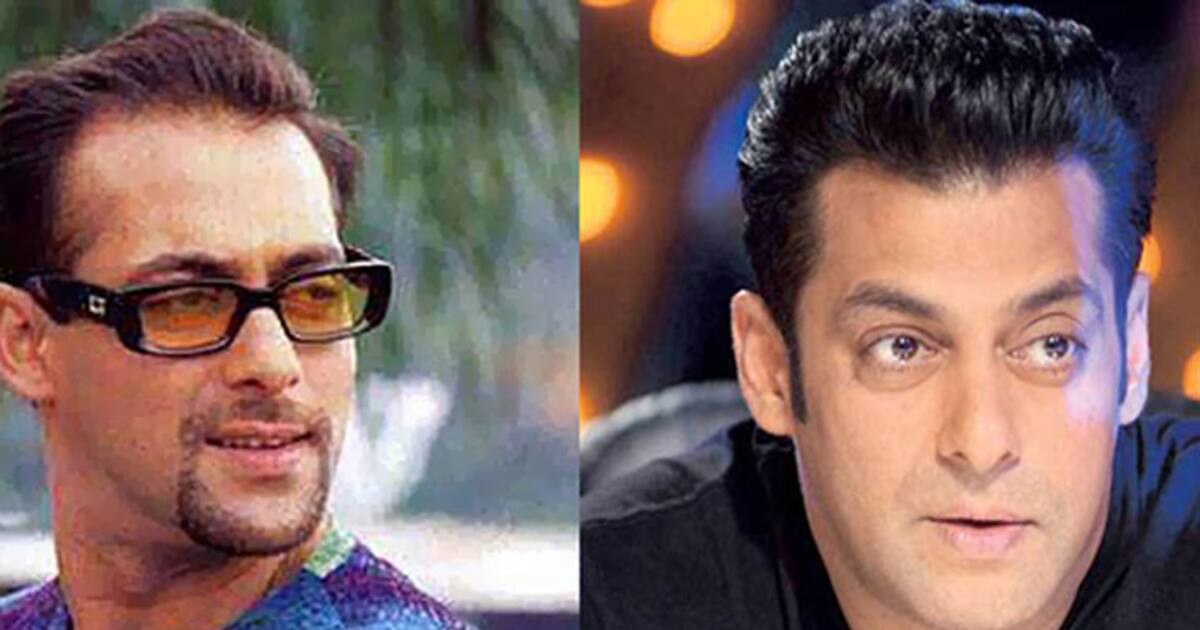 Pakistani Actor Syed Hasans Hair Transplant Goes Wrong