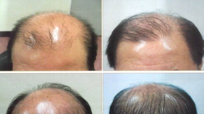 Here are some of the best tips to grow your hair thoroughly. Here are some of the best tips to grow your hair thoroughly.