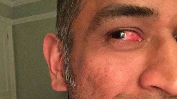 Mahendra Singh Dhoni lucky to survive freak accident against Zimbabwe Mahendra Singh Dhoni lucky to survive freak accident against Zimbabwe