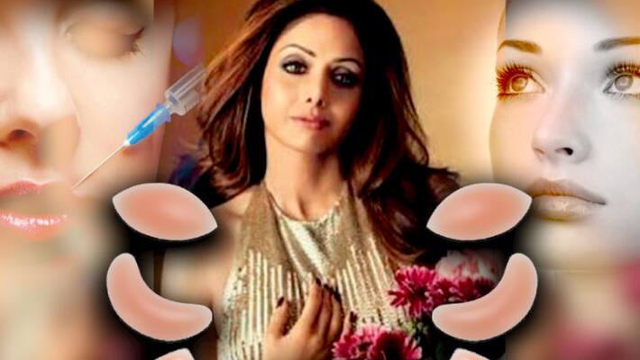 Are cosmetic surgeries done on Sridevi the reason for her death Are cosmetic surgeries done on Sridevi the reason for her death