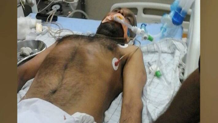 CPIM leader attacked in kottayam CPIM leader attacked in kottayam