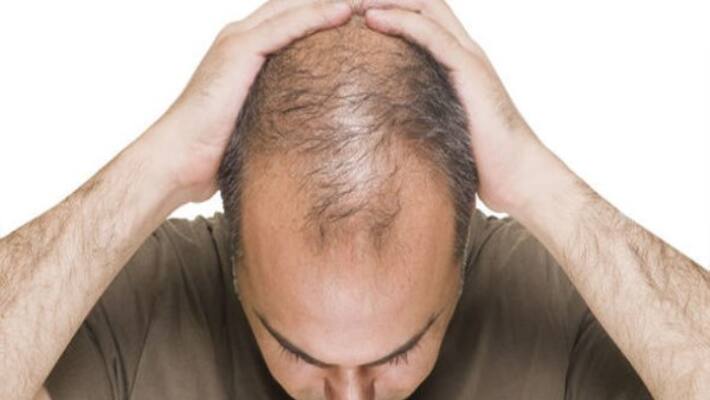 use egg yolk along with apple to grow hair in baldness use egg yolk along with apple to grow hair in baldness