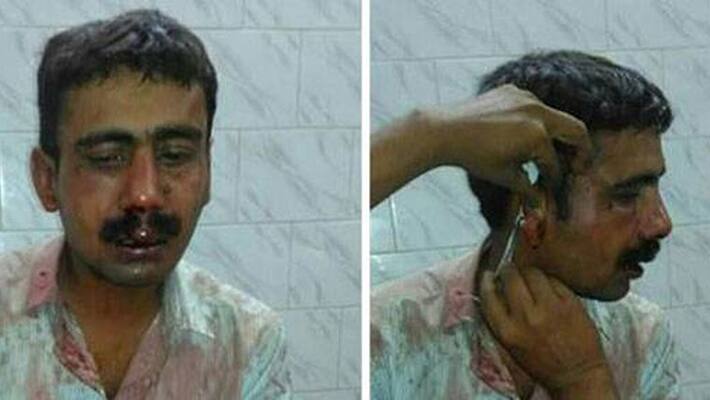 Telegraph employee abducted thrashed in road rage incident in Patna Telegraph employee abducted thrashed in road rage incident in Patna