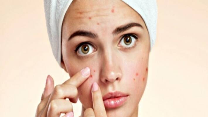 These three herbs are enough to get rid of all the problems in the skin ... get it easily These three herbs are enough to get rid of all the problems in the skin ... get it easily