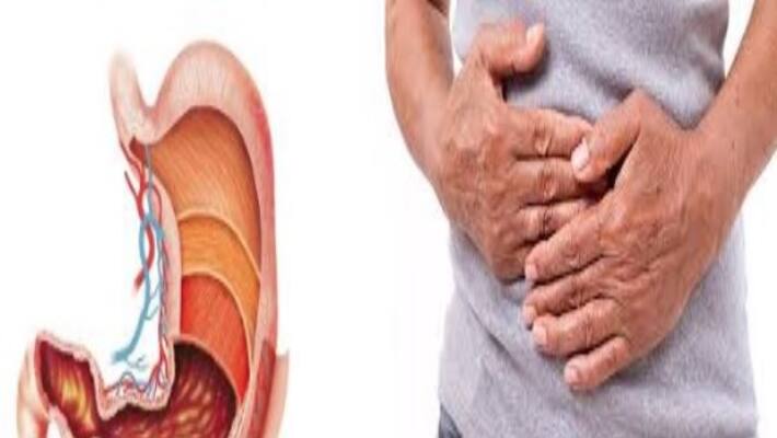 digestion problem takes place after lunch digestion problem takes place after lunch