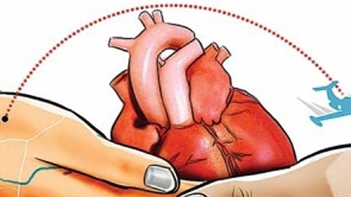 SC asks Centre to examine representation on framing of uniform rules for cadaveric organ transplant SC asks Centre to examine representation on framing of uniform rules for cadaveric organ transplant