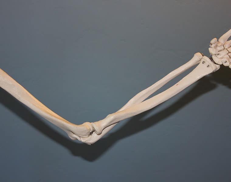 small bone injury stops density of other bones