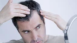 How to prevent your hairs today s health tips