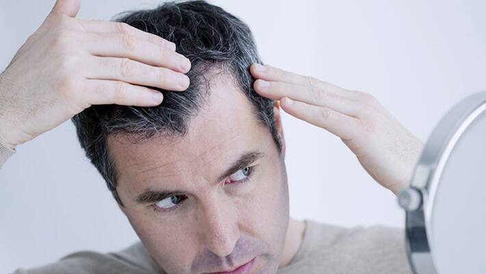 to reduce the problem of white hair you have to avoid these foods to reduce the problem of white hair you have to avoid these foods