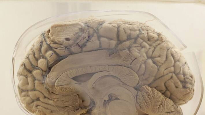 baby born to brain-dead mother after almost 4 months baby born to brain-dead mother after almost 4 months