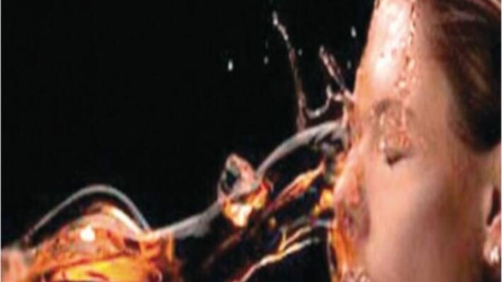 husband throws acid on his wife for giving birth to a girl child husband throws acid on his wife for giving birth to a girl child