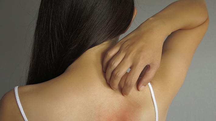 allergy can be prevented at home allergy can be prevented at home