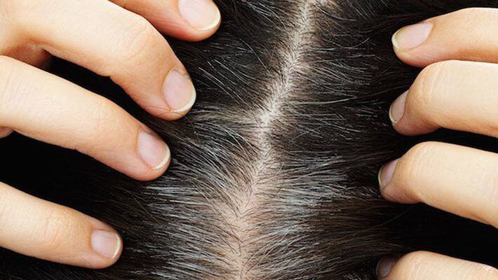 Are you suffering gray hair problem change to your diet today Are you suffering gray hair problem change to your diet today