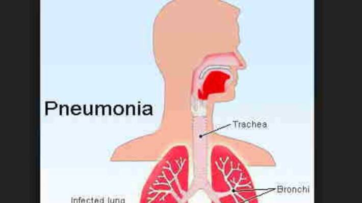 Use this method to clean lungs Use this method to clean lungs